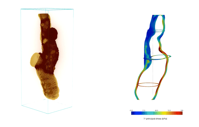 Comparison of carotid stress analyses with and without residual strains