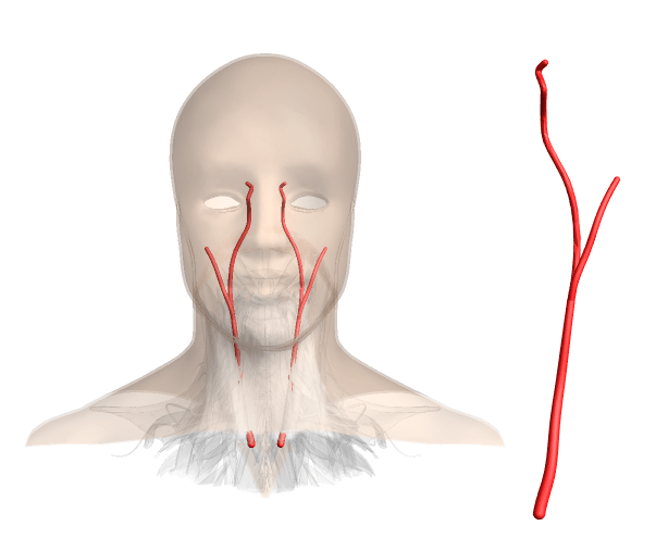 Graphics about carotid arteries